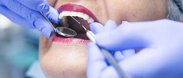 Best Emergency Treatment for Dental Infections or Abscesses in Wyncote, PA